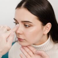 Rhinoplasty
