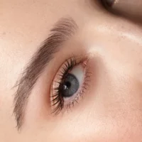 Brow Lift